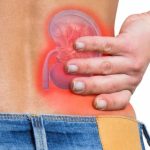10 Cara Mengidentifikasi dan Mengatasi Nyeri Ginjal