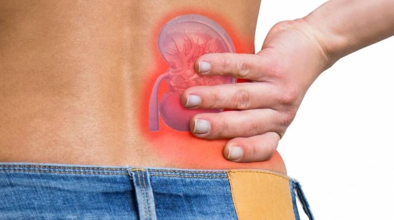 10 Cara Mengidentifikasi dan Mengatasi Nyeri Ginjal