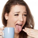 10 Cara Mengatasi Lidah Terbakar karena Makanan Panas