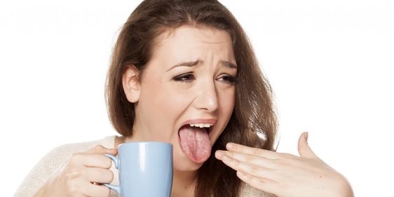 10 Cara Mengatasi Lidah Terbakar karena Makanan Panas 10 Cara Mengatasi Lidah Terbakar karena Makanan Panas