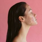 10 Cara Mengurangi Jerawat Hormonal Secara Alami