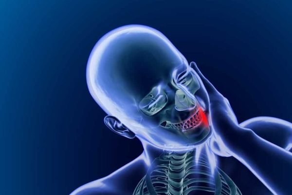 10 Cara Membedakan Nyeri Rahang Akibat Gigi atau Sendi 10 Cara Membedakan Nyeri Rahang Akibat Gigi atau Sendi
