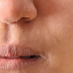 7 Langkah Menghindari Bibir Kering Saat Puasa